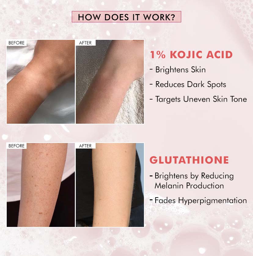 Brightening Tan Removal 1% Kojic Acid & Glutathione Guava Fizz Soap - 300g (3x100g)
