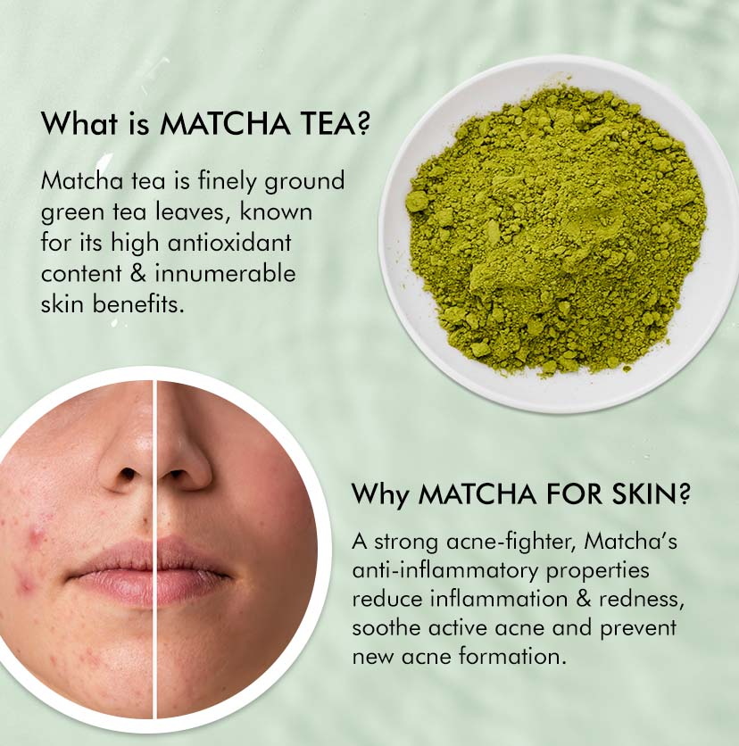 1% Salicylic Acid 1% Succinic Acid Acne Arrest Spot Corrector with Matcha Tea-15 ml