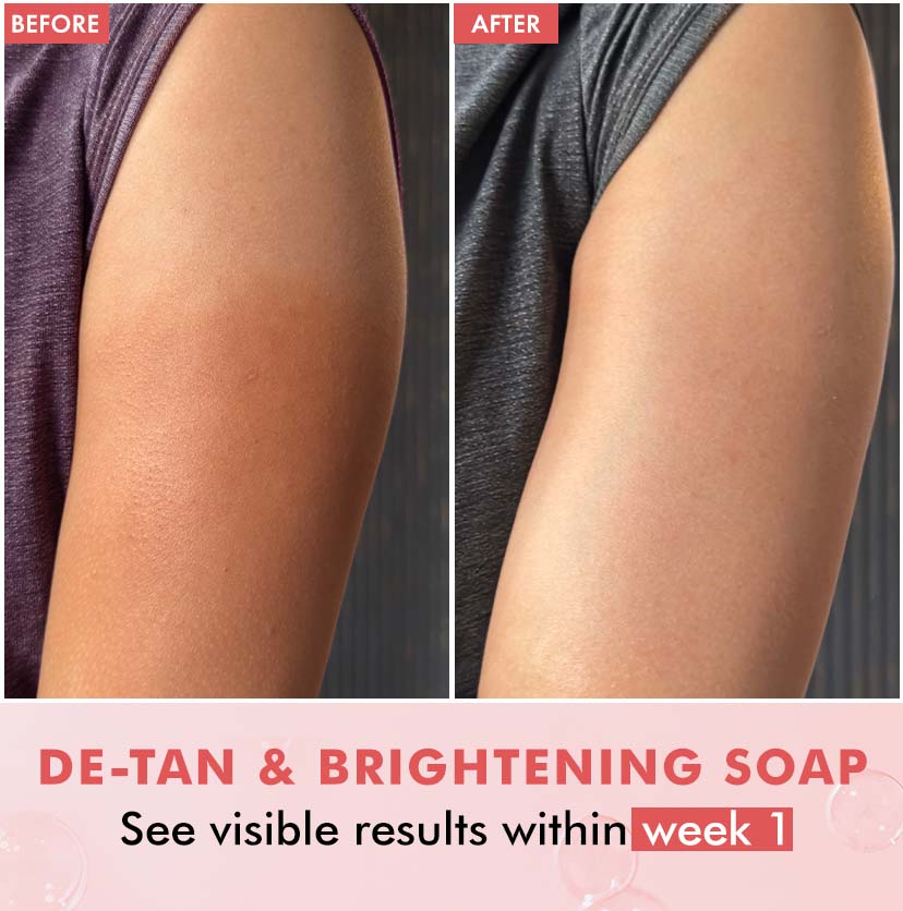 Brightening Tan Removal 1% Kojic Acid & Glutathione Guava Fizz Soap - 300g (3x100g)